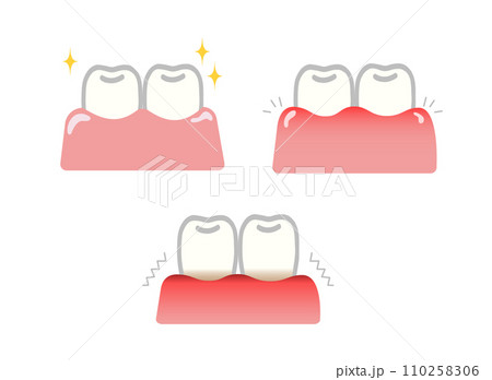 歯と歯茎のイラストセット 110258306