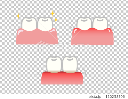 歯と歯茎のイラストセット 110258306