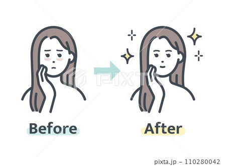 クマ解消前後 110280042