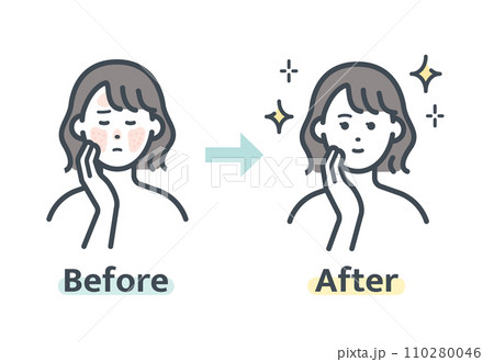 赤ら顔解消前後 赤ら顔解消前後 110280046