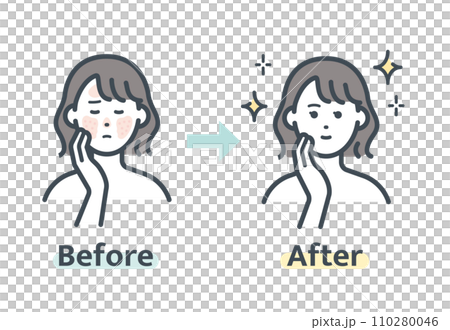 赤ら顔解消前後 赤ら顔解消前後 110280046