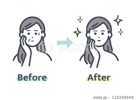 しわ解消前後 110280049