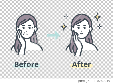 しわ解消前後 110280049