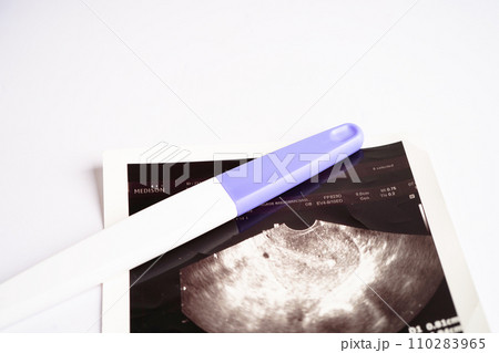 Pregnancy test with ultrasound scan photo of fetus, maternity, childbirth, birth control. Pregnancy test with ultrasound scan photo of fetus, maternity, childbirth, birth control. 110283965
