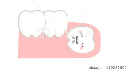 歯茎に埋没した歯 親知らずのイラスト　主線あり 110285802