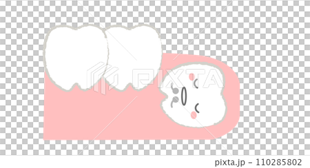 歯茎に埋没した歯 親知らずのイラスト　主線あり 110285802