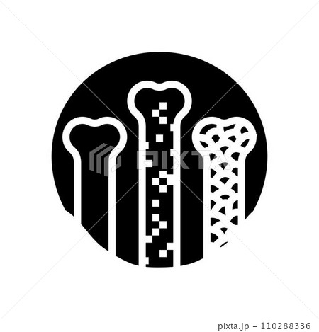 density bone osteoporosis glyph icon vector illustration density bone osteoporosis glyph icon vector illustration 110288336