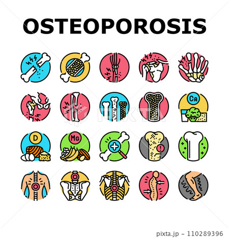 osteoporosis bone pain calcium icons set vector osteoporosis bone pain calcium icons set vector 110289396
