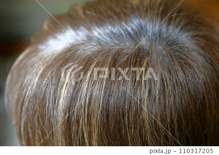 生え際に白髪が目立ってきた女性 110317205