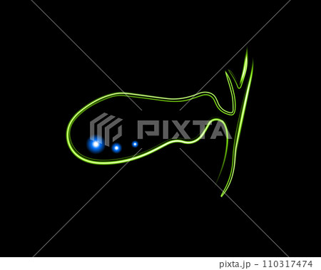 Vector isolated illustration of gall bladder with neon effect. Gallstones. Vector isolated illustration of gall bladder with neon effect. Gallstones. 110317474
