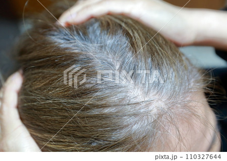 生え際に白髪が目立ってきた女性 110327644