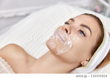 woman with anesthesia cream on lips before procedure lip augmentation 110335824