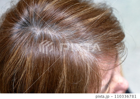 生え際に白髪が目立ってきた女性 生え際に白髪が目立ってきた女性 110336781