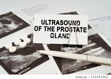 On the ultrasound pictures there is a pen and a business card with the inscription - Ultrasound of the prostate gland On the ultrasound pictures there is a pen and a business card with the inscription - Ultrasound of the prostate gland 110342942