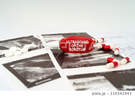 On the ultrasound pictures there are pills and a pen with the inscription - Ultrasound of the scrotum 110342943