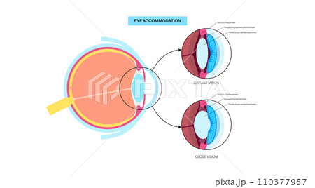 Eye accommodation poster 110377957