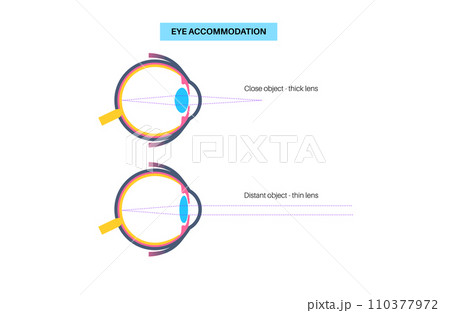 Eye accommodation poster Eye accommodation poster 110377972