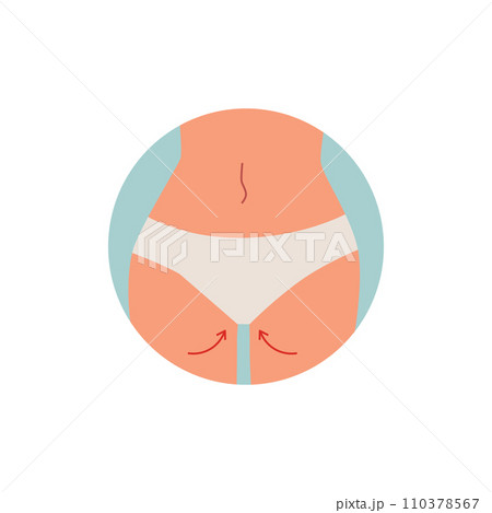 Plastic surgery design concept, female body cartoon vector illustration 110378567