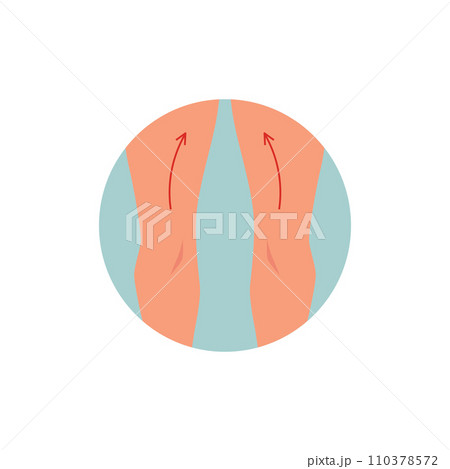 Thighs uplift plastic surgery. Thighs uplift plastic surgery. 110378572