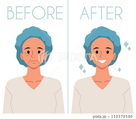 Correction plastic surgery, woman with wrinkles on face Before and lady with a smooth skin After, vector facial lift Correction plastic surgery, woman with wrinkles on face Before and lady with a smooth skin After, vector facial lift 110378580
