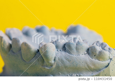 Blue plaster model of an impression of a patient's jaw at an orthodontist dentist on a yellow background. Manufacturing of dentures and crowns for dental prosthetics in orthodontics, macro. Copy space 110431450