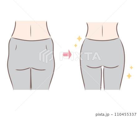 垂れて広がった大きなピーマン尻とスリムなお尻のイラスト 比較・ビフォーアフター 垂れて広がった大きなピーマン尻とスリムなお尻のイラスト 比較・ビフォーアフター 110455337