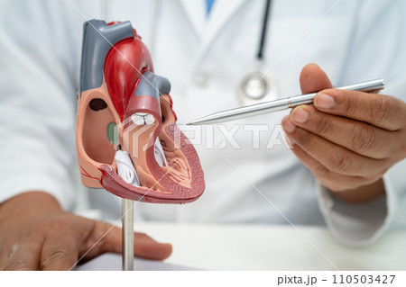 Cardiovascular disease CVD, Asian doctor holding human anatomy model for learn and treat heart disease. Cardiovascular disease CVD, Asian doctor holding human anatomy model for learn and treat heart disease. 110503427