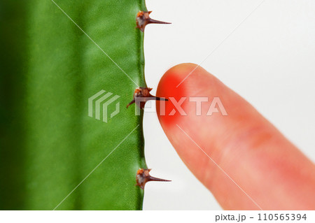 Painful finger prick from a cactus thorn. Red skin from inflammation. Pain concept 110565394