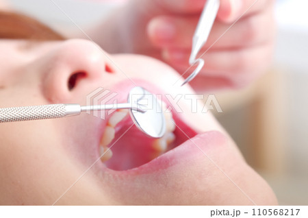 歯科治療を受ける女性 歯科治療を受ける女性 110568217