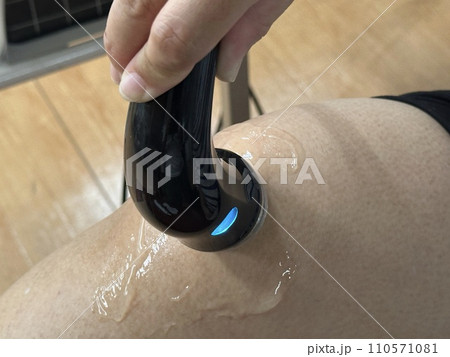 超音波治療(ハイボルテージ) 超音波治療(ハイボルテージ) 110571081