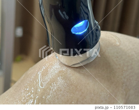 超音波治療（ハイボルテージ） 110571083