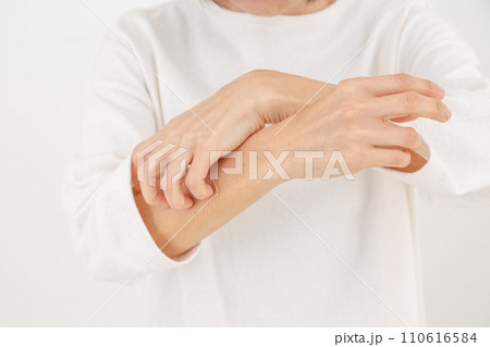 手の乾燥に苦しむミドル女性 110616584