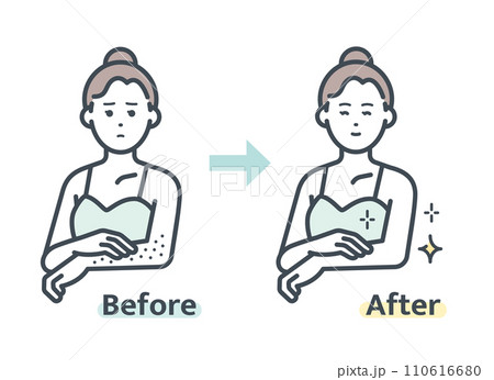 腕の脱毛前後 腕の脱毛前後 110616680