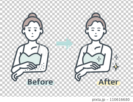 Before and after arm hair removal 110616680