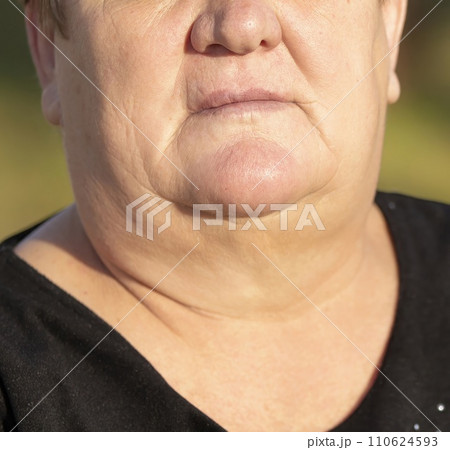 Signs of aging on the face of a plump sixty-year-old woman. Signs of aging on the face of a plump sixty-year-old woman. 110624593