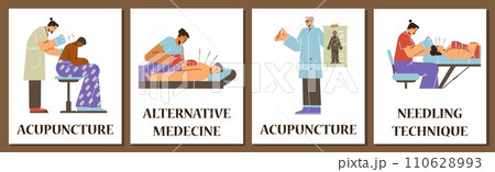 Acupuncture therapy posters for social media and apps, flat vector illustration. 110628993
