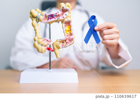 Doctor holding Blue ribbon with human Colon anatomy model. March Colorectal Cancer Awareness month, Colonic disease, Large Intestine, Ulcerative colitis, Digestive system and Health concept Doctor holding Blue ribbon with human Colon anatomy model. March Colorectal Cancer Awareness month, Colonic disease, Large Intestine, Ulcerative colitis, Digestive system and Health concept 110639617