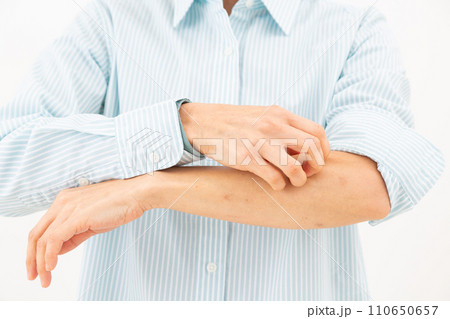 手の乾燥に苦しむミドル女性 手の乾燥に苦しむミドル女性 110650657