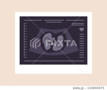 Ultrasound of twins. Embryos in womb. Pregnancy screening. Babies health diagnostic. Fetus silhouettes photo. Sonography or ultrasonography concept. Vector illustration in flat cartoon style Ultrasound of twins. Embryos in womb. Pregnancy screening. Babies health diagnostic. Fetus silhouettes photo. Sonography or ultrasonography concept. Vector illustration in flat cartoon style 110694073