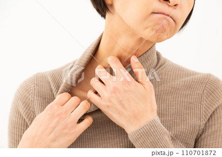 乾燥肌の首元をかくミドル女性 乾燥肌の首元をかくミドル女性 110701872