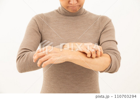 手の乾燥に苦しむミドル女性 手の乾燥に苦しむミドル女性 110703294