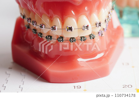 Dental appointment reminder in calendar, healthy teeth, dental health care. Dental appointment reminder in calendar, healthy teeth, dental health care. 110734178