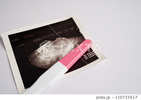 Pregnancy test with ultrasound scan photo of fetus, maternity, childbirth, birth control. 110735617