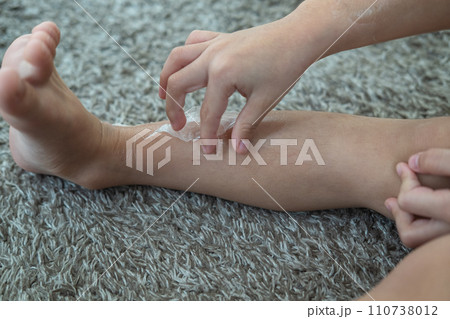 Little Asian boy's hands peeling off dry skin on his legs. Skin problems. 110738012