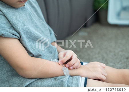 Little Asian boy's hands peeling off dry skin on his arm. Skin problems. Little Asian boy's hands peeling off dry skin on his arm. Skin problems. 110738019