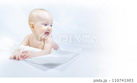 a baby with a hemangioma on his neck lies on a white background 110741903