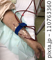 人工透析治療の様子 110763360