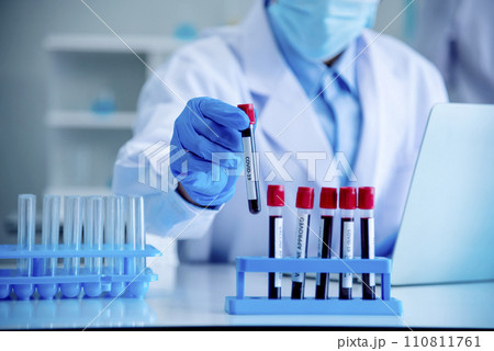 Close up Doctor clinic healthcare technician lab testing blood sample diagnosis. Crop man scientist hands testing medical lab. Scientist man hands holding sample blood test tube science laboratory. 110811761