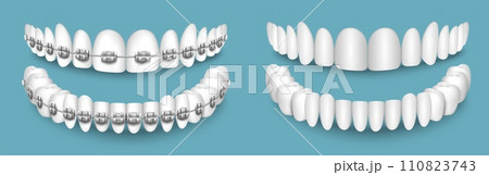 Teeth with or without braces orthodontic dentistryのイラスト素材 [110823743 ...