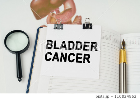 On the table there is a magnifying glass and a notepad with the inscription - Bladder cancer 110824962
